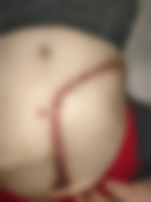 深圳吴小兵医疗美容诊所怎么样，价格表