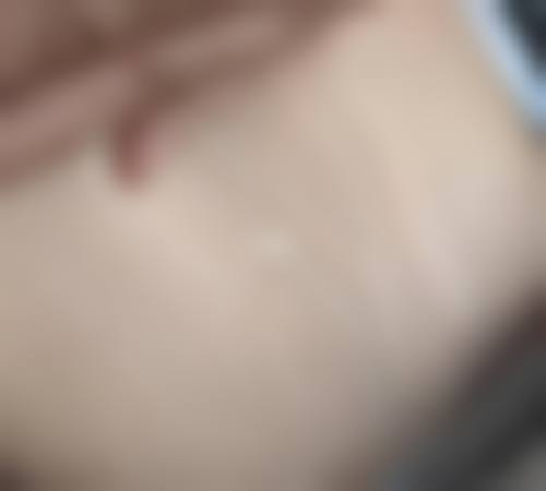 贵阳易莱美整形医院口碑好不好？附真实患者口碑评价