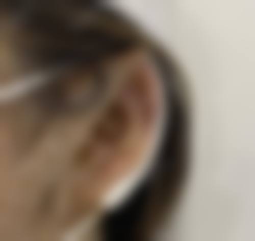 汕头爱都沪美人整形医院地址及乘车路线怎么样