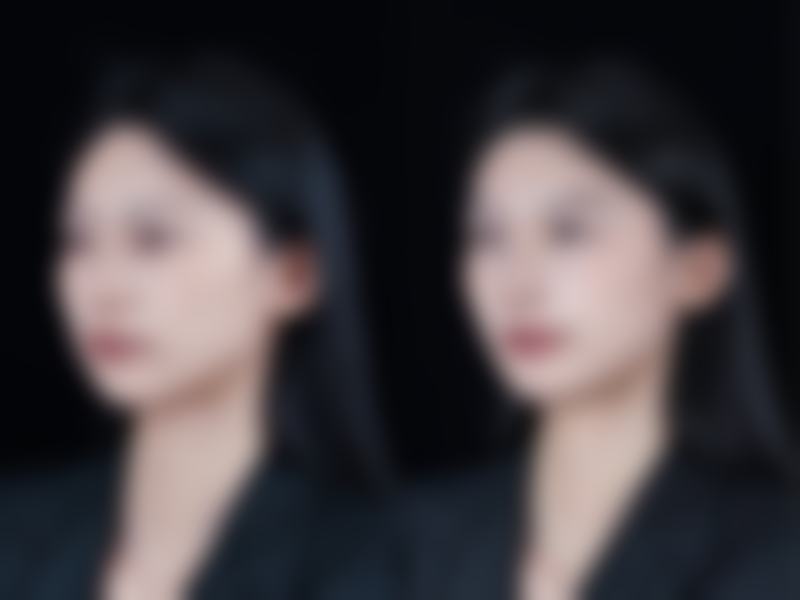 甲状腺手术后有疤痕增生怎么办？3招淡化增生疤痕，护理要点全解析