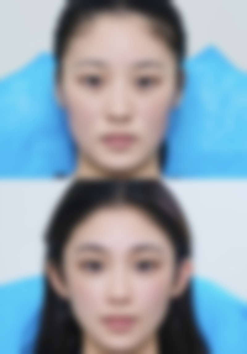 头发种植究竟好不好——形象改善篇