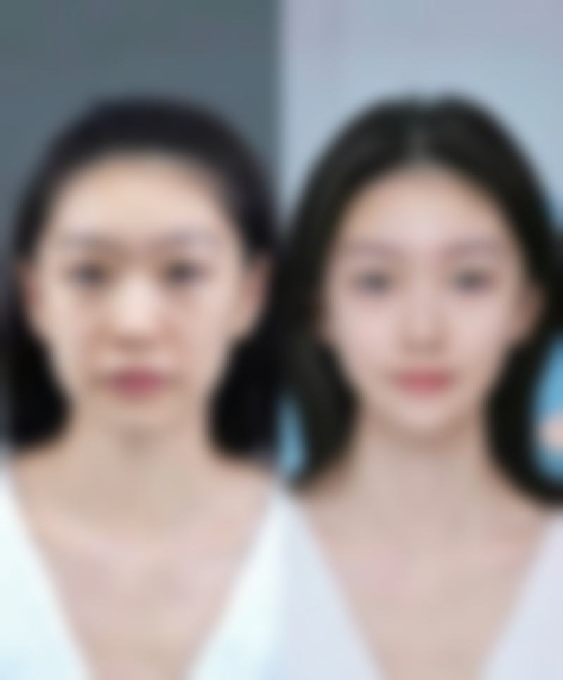 成都柠萌医疗美容门诊部顾客实例