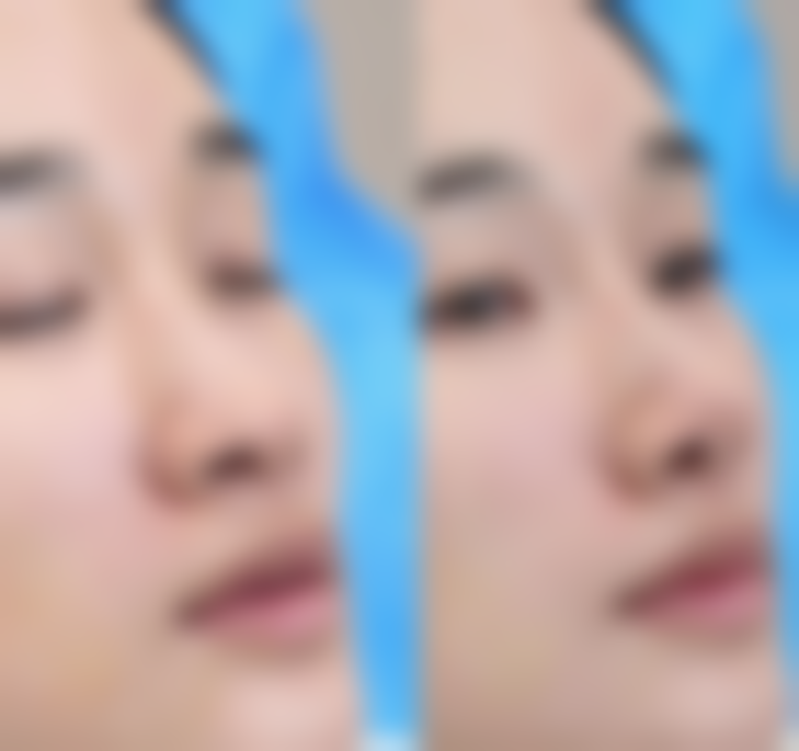 吉林元美整形医院口碑好不好？附真实患者口碑评价