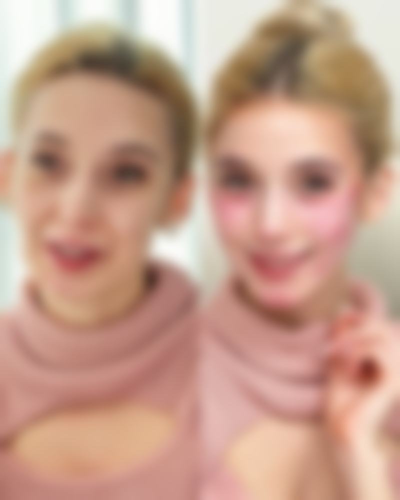 终极问答：切开双眼皮专属美丽年限的计算