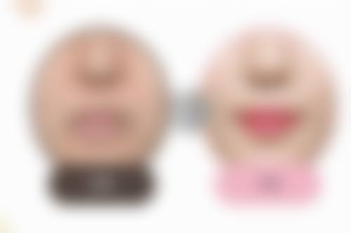 怎样去掉黑眼圈眼袋：常见误区与真相