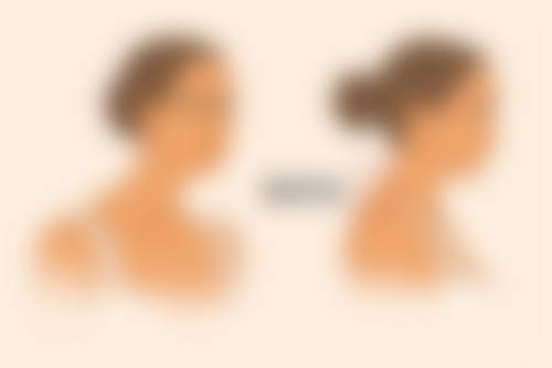 内窥镜隆胸成效影响因素：医生、材料与护理