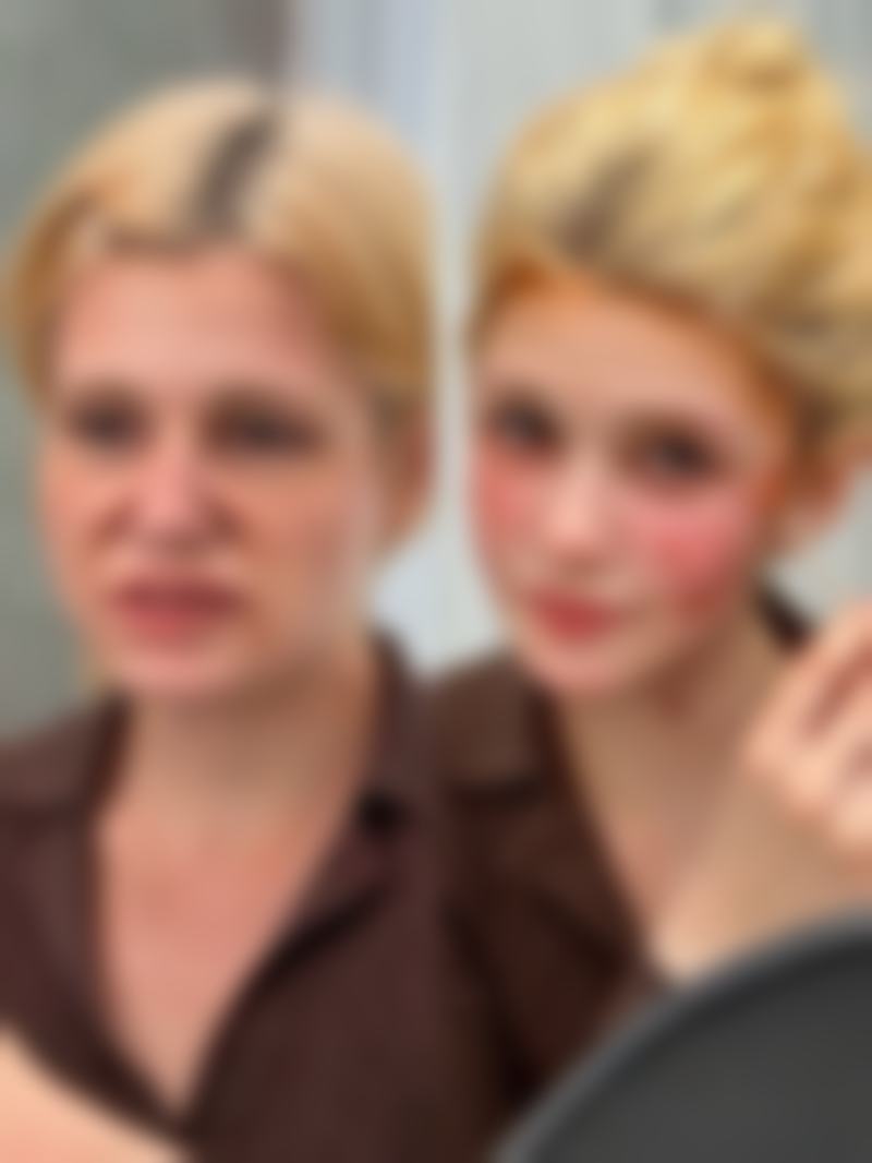 割双眼皮的方式与医院选择：三等甲与私立各有千秋