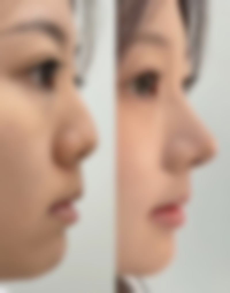 南通英莎医疗美容门诊部价格表