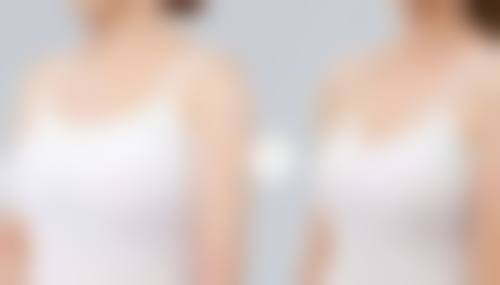 三、天津晴宇整形医院怎么样,口碑评价如何?