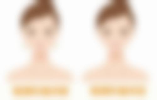 结尾：做好术前准备，耐心修复疤痕