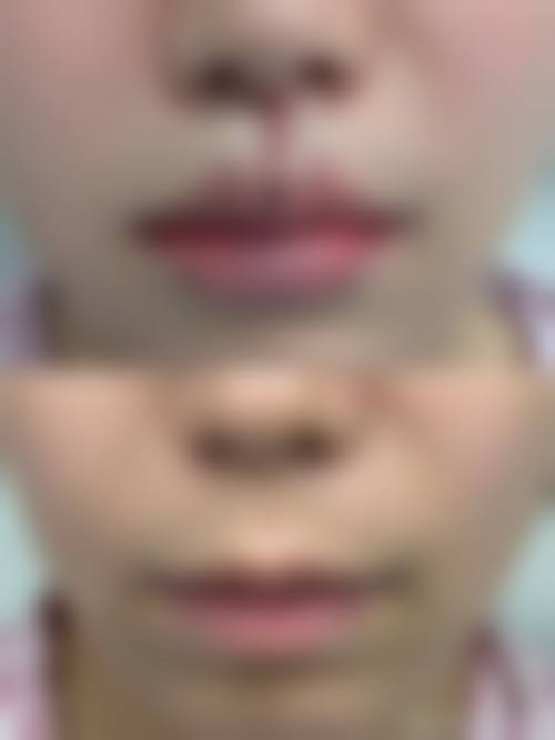 宿州市汉密尔顿医学美容整形医生简介