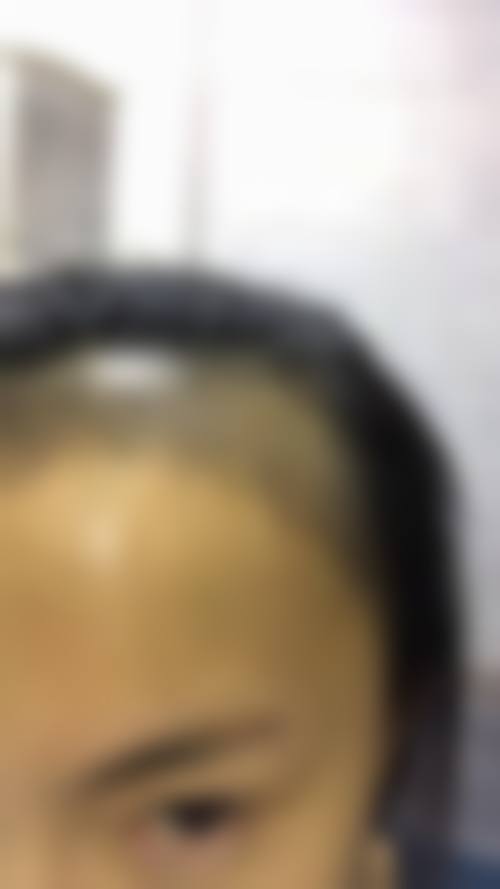 台州韩黛美医疗美容医院口碑好不好?附真实患者口碑评价