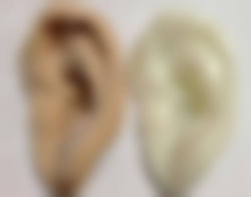 董雷医生简介之项目优势