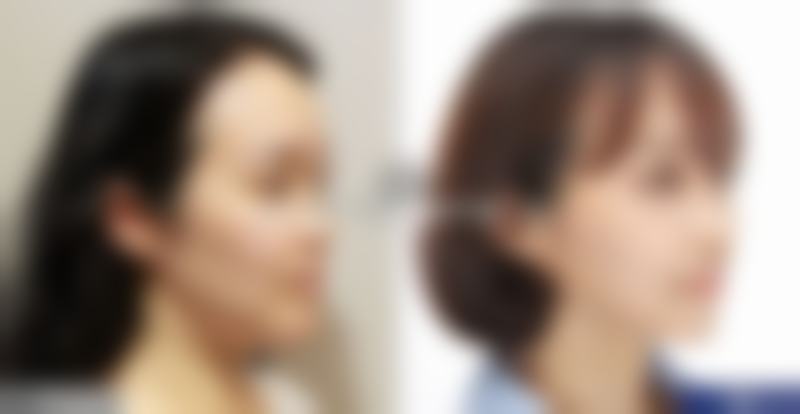 上海保加整形医院医疗美容怎么样价格表