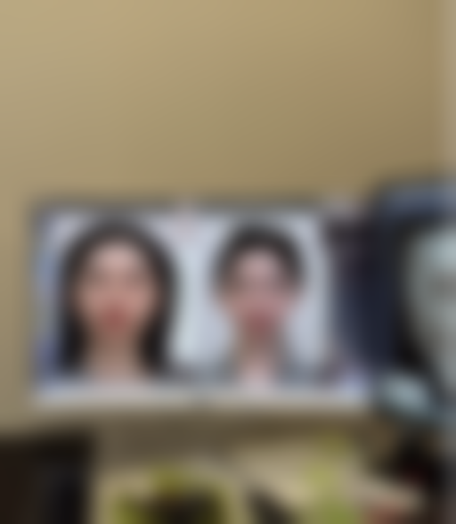 腿部抽脂后多久可以见成效：解锁“筷子腿”的艰难倒计时