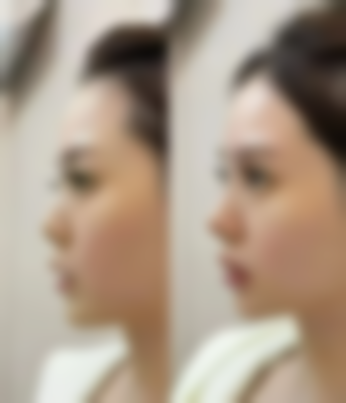 程凯医生简介：项目优势