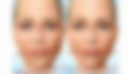 深圳宝安区人民医院医疗美容科项目特色