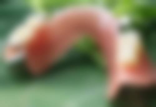 埋线双眼皮后冰敷频率：微创手术的温柔呵护