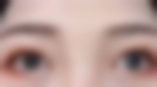 手术疤痕怎么才能淡化掉——激光祛疤的神奇成效