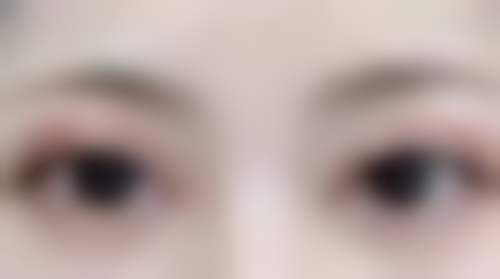 深圳宝安区人民医院医疗美容科地址及乘车路线