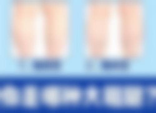 修复烫伤疤痕的办法有哪些:自然温和修复技巧