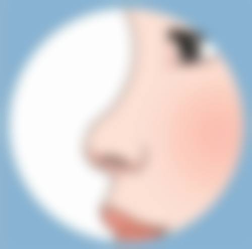 冰敷期间的注意事项：严守禁忌保修复