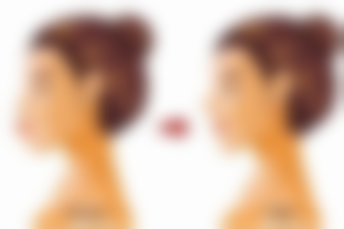 终极建议：如何安心变得更美？