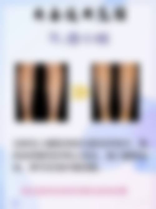 全切双眼皮后冰敷频率与特殊护理要点