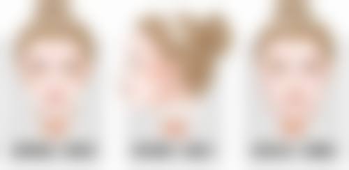 手术疤痕怎么才能淡化掉——等待与坚持的过程