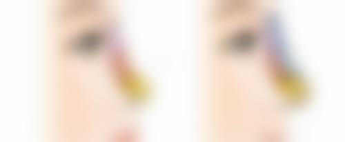 隆胸手术属于大手术吗？私立/专精整形医院的特色与考量