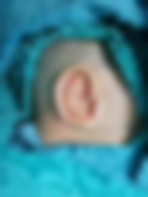 【眼袋整形+6000】武汉斯启诺医疗美容顾客实例