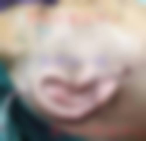 杭州元医整形医院口碑好不好