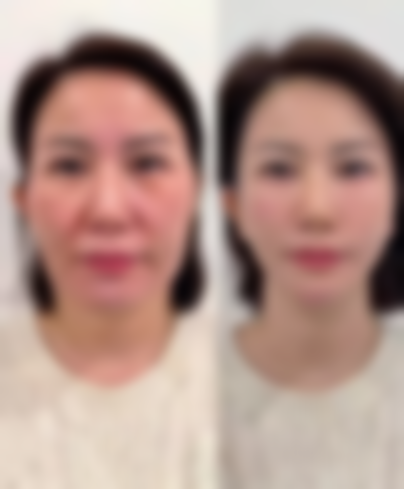 山东省更出名的医美医院——山东第一医 科 大学附属皮肤病医院