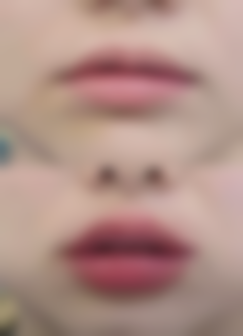 北京三等甲医院假体隆胸后取出疼吗：体验分享与优势展现