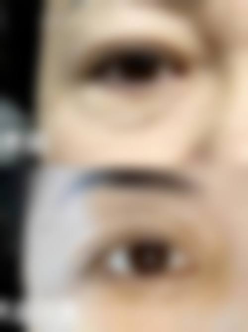 韩国eyemagic李喜文整形医院价格表