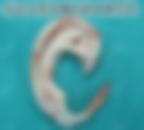 杭州悦可医疗美容诊所邹霞求美者变得更美体验