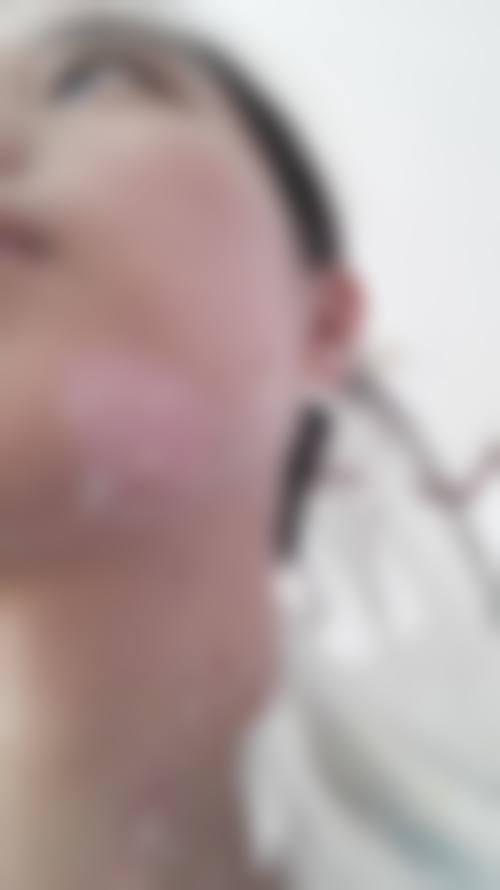 佛山市妇幼保健院皮肤美容科正规吗怎么样