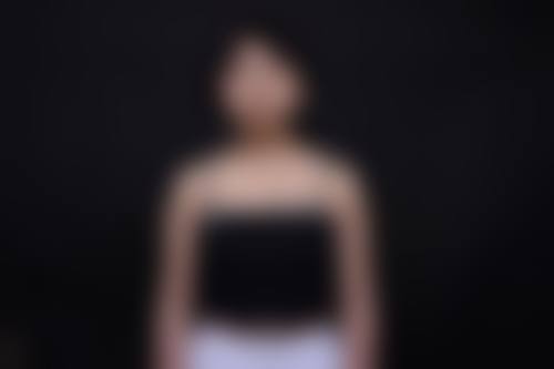 青岛白华宝昕晟美医疗整形美容抖音团购活动及价格表