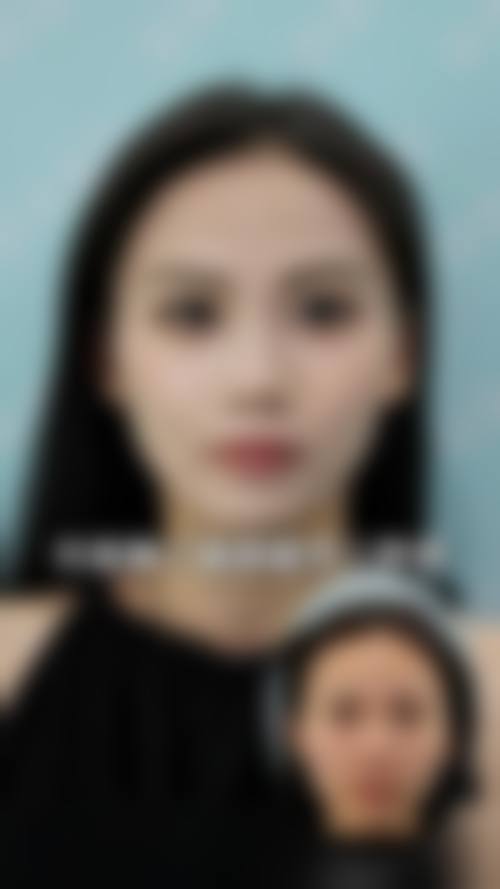 乌鲁木齐严代琼医疗美容诊所怎么样，价格表