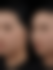 韩国eyemagic李喜文整形医院基本信息