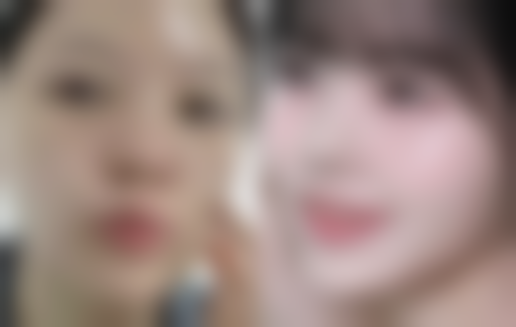 南通英莎医疗美容门诊部李辉做过的真实反馈——如皋星秘医疗美容门诊部