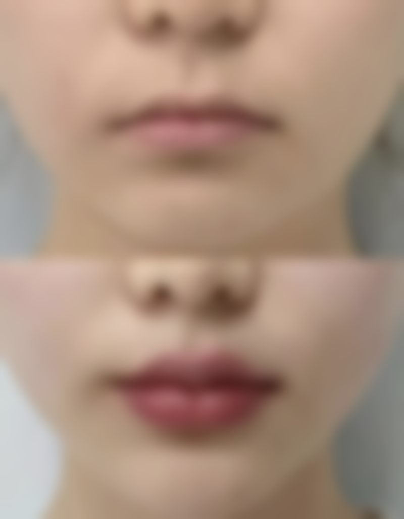 青岛诺美德整形医院口碑好不好