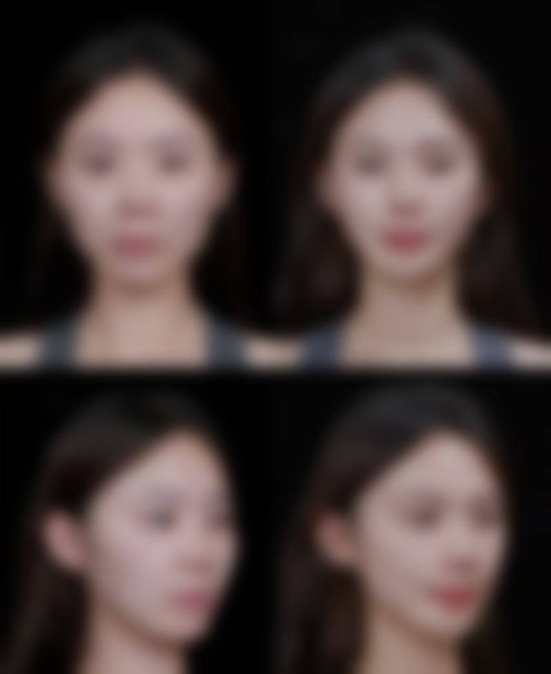 普宁韩媄医疗美容门诊部更擅长什么