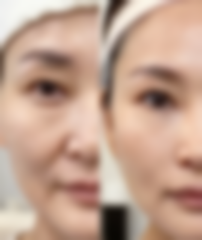 昆明海峡医疗美容诊所怎么样，评价