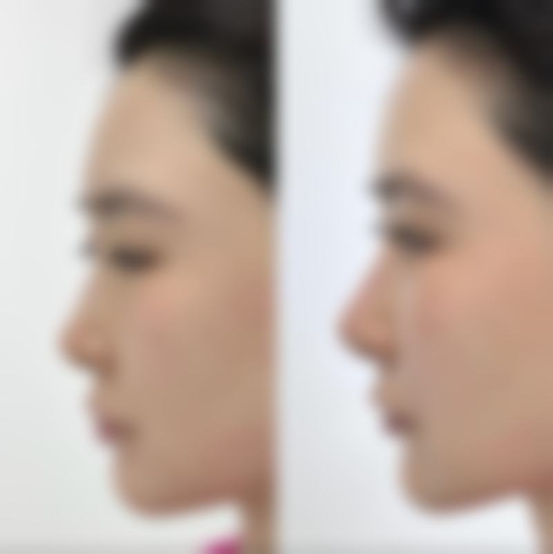 昆明海峡医疗美容诊所怎么样，可靠吗