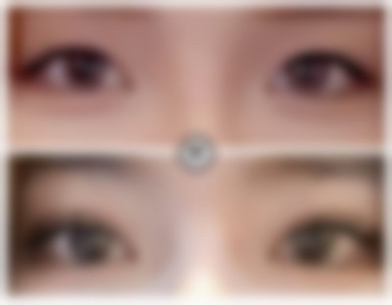 韩国eyemagic李喜文整形医院项目特色