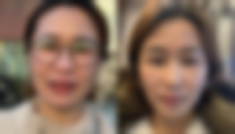 台州市维德医疗美容门诊部怎么样，有哪些顾客实例