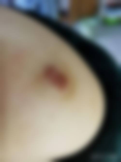 伊美芝皮肤科医生简介