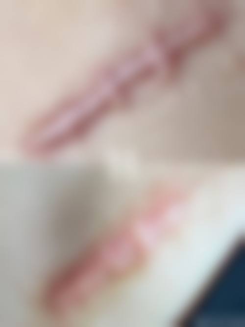 韩国一见整形医院项目特色