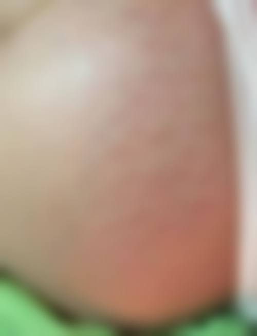 海口针美汇医疗美容门诊部怎么样，价格表情况